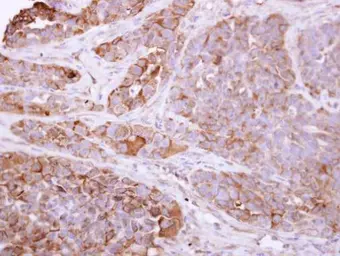 Anti-Talin-1 antibody [C3], C-term used in IHC (Paraffin sections) (IHC-P). GTX102215