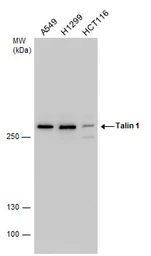 Anti-Talin-1 antibody [C3], C-term used in Western Blot (WB). GTX102215