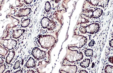 Anti-KAP1 antibody [N3C2], Internal used in IHC (Paraffin sections) (IHC-P). GTX102226