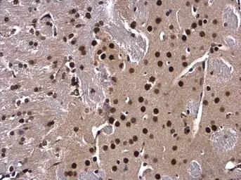 Anti-XBP1 antibody [N3C3] used in IHC (Paraffin sections) (IHC-P). GTX102229