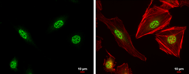 Anti-XBP1 antibody [N3C3] used in Immunocytochemistry/ Immunofluorescence (ICC/IF). GTX102229