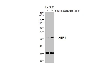 Anti-XBP1 antibody [N3C3] used in Western Blot (WB). GTX102229