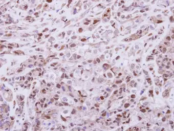 Anti-DPF2 antibody used in IHC (Paraffin sections) (IHC-P). GTX102235