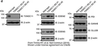 Anti-alpha Glucosidase II antibody [N1N2], N-term used in Western Blot (WB). GTX102237