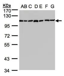 Anti-alpha Glucosidase II antibody [N1N2], N-term used in Western Blot (WB). GTX102237