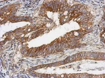 Anti-TSFM antibody used in IHC (Paraffin sections) (IHC-P). GTX102238