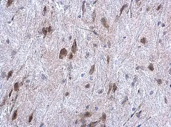 Anti-ORP150 antibody [C2C3], C-term used in IHC (Paraffin sections) (IHC-P). GTX102255