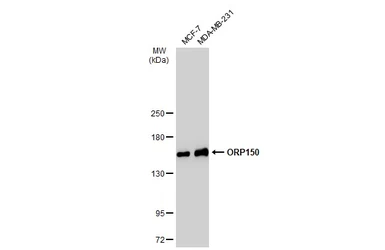 Anti-ORP150 antibody [C2C3], C-term used in Western Blot (WB). GTX102255