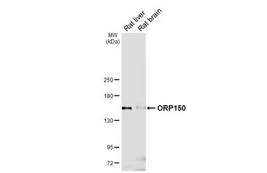 Anti-ORP150 antibody [C2C3], C-term used in Western Blot (WB). GTX102255