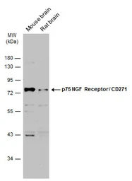 Anti-p75 NGF Receptor / CD271 antibody used in Western Blot (WB). GTX102262