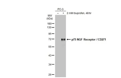 Anti-p75 NGF Receptor / CD271 antibody used in Western Blot (WB). GTX102262
