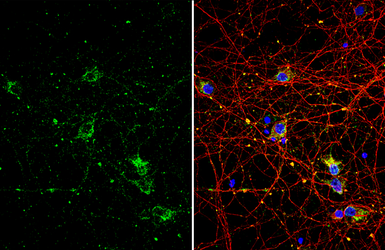 Anti-p75 NGF Receptor / CD271 antibody used in Immunocytochemistry/ Immunofluorescence (ICC/IF). GTX102262