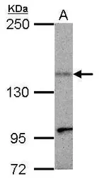Anti-KIF1C antibody [N3C2], Internal used in Western Blot (WB). GTX102264