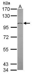 Anti-GCP2 antibody [N1N2], N-term used in Western Blot (WB). GTX102281
