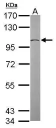 Anti-GCP2 antibody [N1N2], N-term used in Western Blot (WB). GTX102281