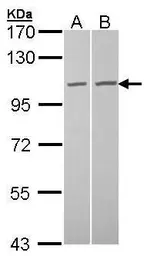Anti-GCP2 antibody [N1N2], N-term used in Western Blot (WB). GTX102281