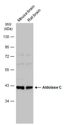 Anti-Aldolase C antibody [N1C1] used in Western Blot (WB). GTX102284