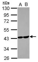 Anti-Aldolase C antibody [N1C1] used in Western Blot (WB). GTX102284