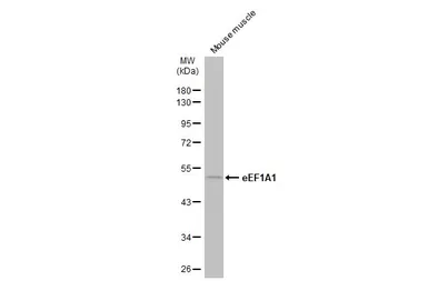 Anti-eEF1A1 antibody [N1C1] used in Western Blot (WB). GTX102285