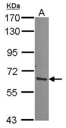 Anti-Proteasome 26S S3 antibody [N1N3] used in Western Blot (WB). GTX102290