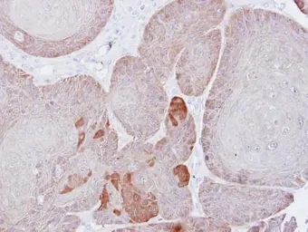Anti-Proteasome 26S S3 antibody [N1N3] used in IHC (Paraffin sections) (IHC-P). GTX102290