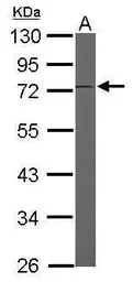 Anti-EEF1D antibody [N1C3] used in Western Blot (WB). GTX102292