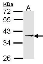 Anti-EEF1D antibody [N1C3] used in Western Blot (WB). GTX102292