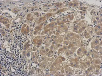 Anti-ALS antibody used in IHC (Paraffin sections) (IHC-P). GTX102294
