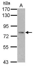 Anti-ALS antibody used in Western Blot (WB). GTX102294