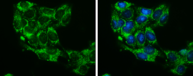 Anti-Glycerol kinase antibody [N3C2], Internal used in Immunocytochemistry/ Immunofluorescence (ICC/IF). GTX102297