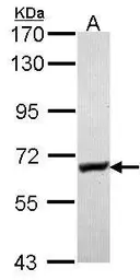 Anti-Glycerol kinase antibody [N3C2], Internal used in Western Blot (WB). GTX102297