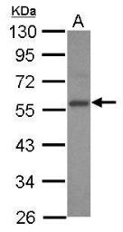 Anti-E2F3 antibody [N2C3] used in Western Blot (WB). GTX102302