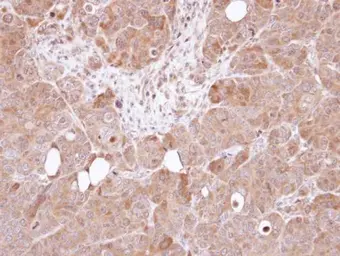 Anti-AHA-1 antibody [N1C1] used in IHC (Paraffin sections) (IHC-P). GTX102312