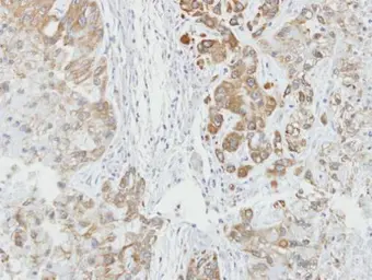 Anti-AHA-1 antibody [N2C3] used in IHC (Paraffin sections) (IHC-P). GTX102321