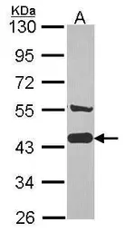 Anti-AHA-1 antibody [N2C3] used in Western Blot (WB). GTX102321