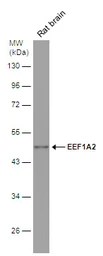 Anti-EEF1A2 antibody used in Western Blot (WB). GTX102326