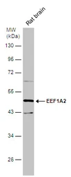 Anti-EEF1A2 antibody [C1C3] used in Western Blot (WB). GTX102327