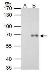 Anti-RelB antibody used in Immunoprecipitation (IP). GTX102333