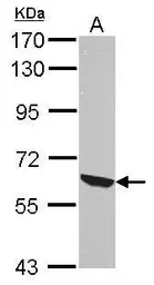 Anti-RelB antibody used in Western Blot (WB). GTX102333