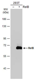 Anti-RelB antibody used in Western Blot (WB). GTX102333