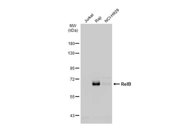 Anti-RelB antibody used in Western Blot (WB). GTX102333
