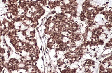 Anti-RelB antibody used in IHC (Paraffin sections) (IHC-P). GTX102333
