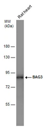 Anti-BAG3 antibody [N1C1] used in Western Blot (WB). GTX102343