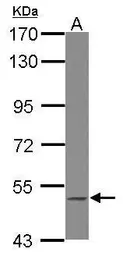 Anti-BLK antibody [N3C2], Internal used in Western Blot (WB). GTX102348