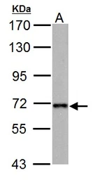 Anti-Nucleoporin p62 antibody used in Western Blot (WB). GTX102359