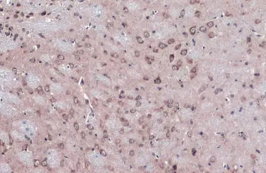 Anti-Nucleoporin p62 antibody used in IHC (Paraffin sections) (IHC-P). GTX102359