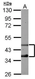 Anti-DP2 antibody [N2C1], Internal used in Western Blot (WB). GTX102365