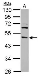 Anti-DP2 antibody [N2C1], Internal used in Western Blot (WB). GTX102365