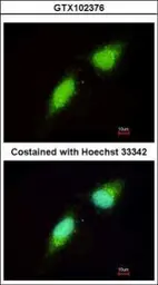 Anti-NADE antibody [N1C3] used in Immunocytochemistry/ Immunofluorescence (ICC/IF). GTX102376