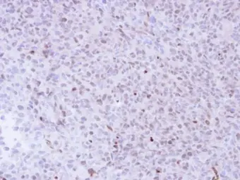 Anti-NADE antibody [N1C3] used in IHC (Paraffin sections) (IHC-P). GTX102376